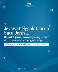 Beda Jerawat, Beda Solusi! Kamu Termasuk yang Mana? Kenali 6 Jenis Jerawat Ini!