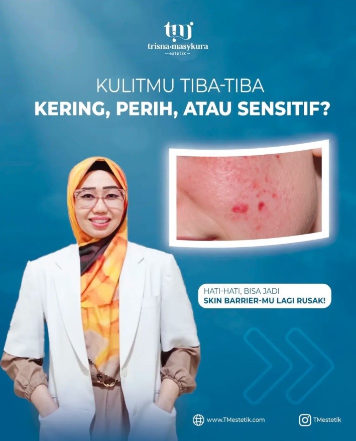 Kulit Tiba-Tiba Kering, Perih, dan Sensitif? Bisa Jadi Skin Barrier Kamu Lagi Rusak!